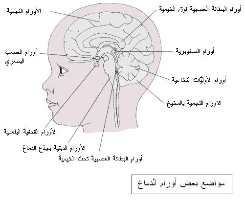 اعراض سرطان الرأس